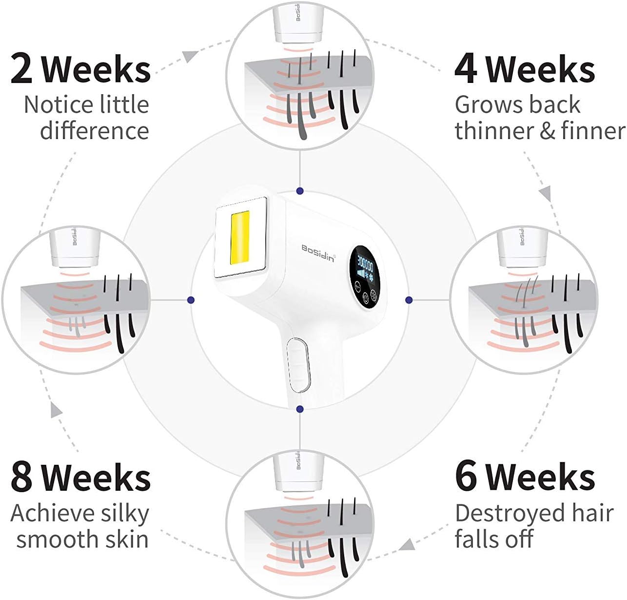 laser hair treatment machine