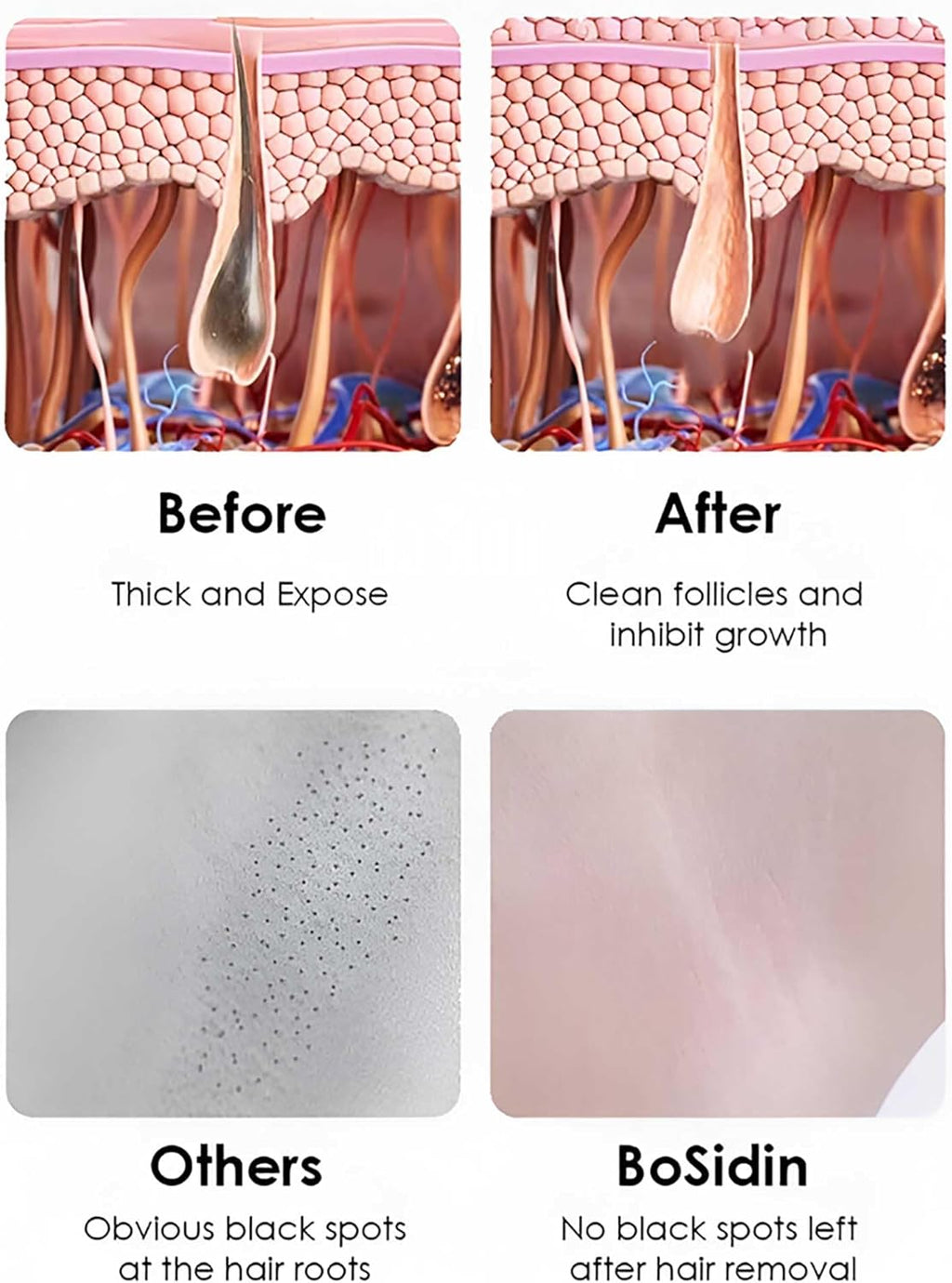 Permanent Laser Hair Removal Machine