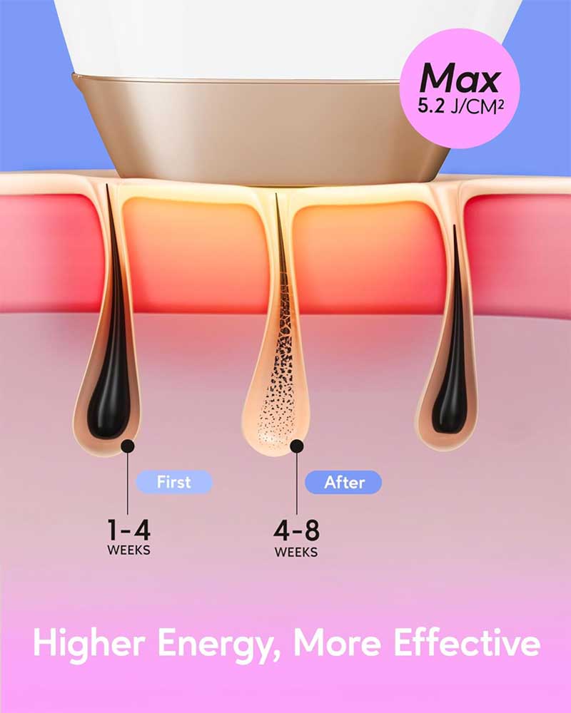 BoSidin Permanent Hair Remover At Home, Upgraded High Energy Levels Laser Hair Removal for Women and Men, 999K Flashes Effective and Safe for Whole Body