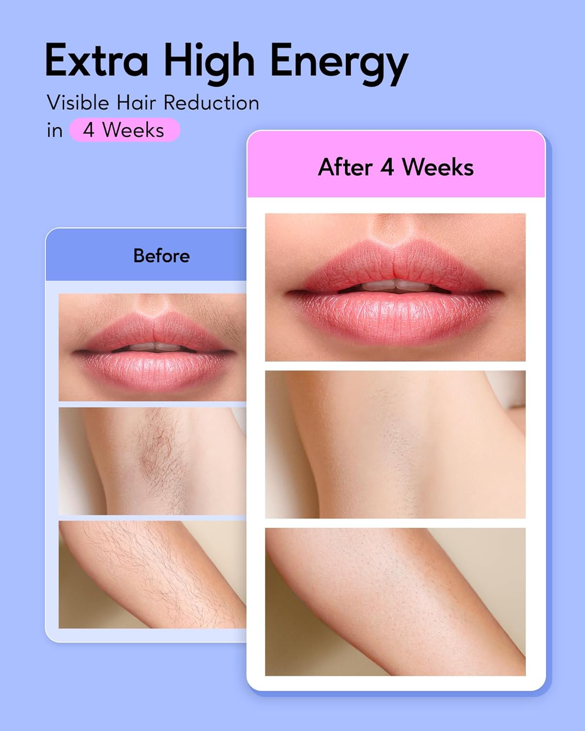 Easy Permanent Hair Reduction at Home for Beginners- BoSidin Essential™